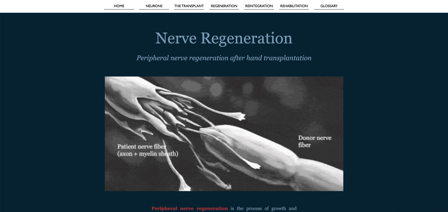 RoadtoRecovery_RegenerationSection