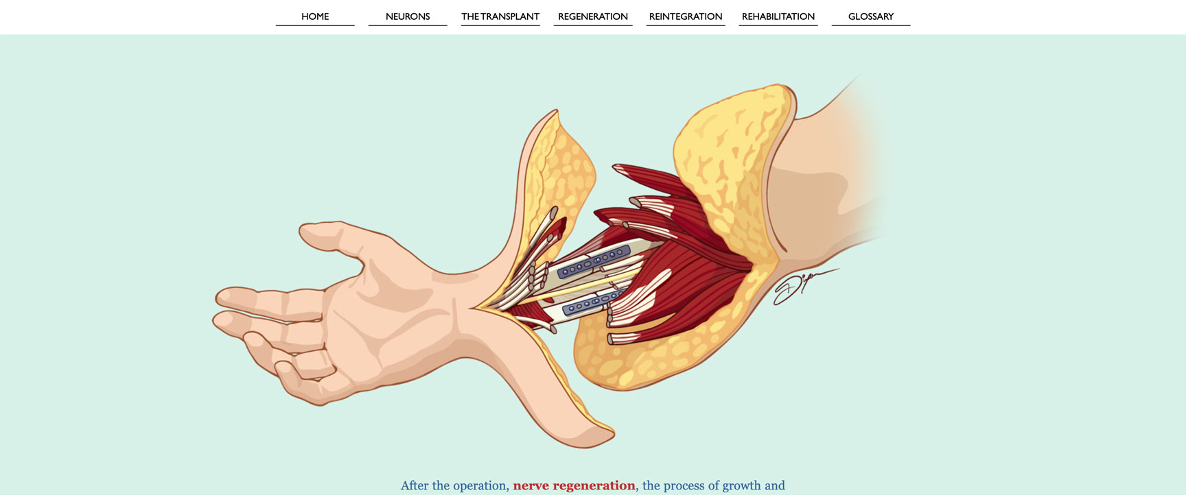 RoadtoRecovery_TransplantSection
