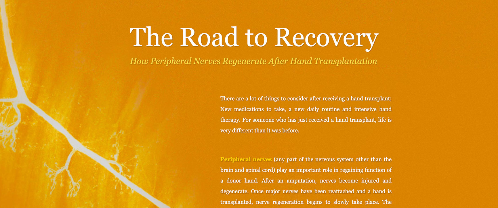 The Road to Recovery